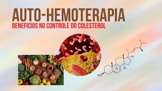 AUTOHEMOTERAPIA BENEFÍCIOS NO CONTROLE DO COLESTEROL [upl. by Stoddart706]