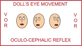 DOLLS EYE MOVEMENT OCULOCEPHALIC REFLEXVESTIBULOOCULAR REFLEX [upl. by Elakram]