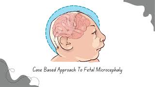 Case Based Approach To Fetal Microcephaly [upl. by Ajroj]