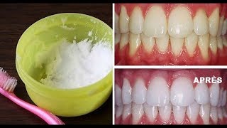 Le Bicarbonate de Soude Pour Des Dents Blanches en seulement 5 Minutes [upl. by Ayotel]