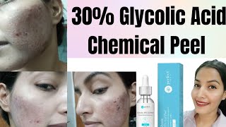 30 Glycolic Acid Chemical Peel At Home ग्लाइकोलिक पील कैसे कब क्यों करें पूरी जानकारी [upl. by Olen]