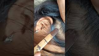 LICEPOPPING lice hair satisfying liceremoval haircare hairstyle hairextensions longhair [upl. by Naujyt]