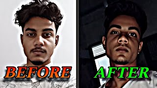 How to Fix Asymmetrical Face NATURALLY in Hindi [upl. by Eedeed]