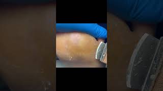 Charming Pedicure Video  Remove Dead Skin [upl. by Enahsal990]