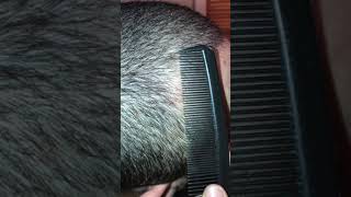 My Boyfriend Let me use a Fine Tooth comb for His Dandruff Scratching Session [upl. by Enamrahc]