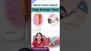 Importance Of Pap Smear Test  The Vital Role of Pap Smear Tests in Cervical Health  shorts [upl. by Dodie]