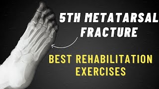 5th Metatarsal Fracture Exercises  6 Week Program [upl. by Jaymie230]