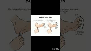 Babinski reflex viralshort medicaleducation humanbody allaboutnorcet norcetstudytips motiv [upl. by Nerval]