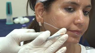 Complete video training on Botulinum Injections for face and Neck [upl. by Nylahsoj]