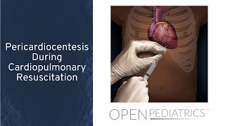 Pericardiocentesis During Cardiopulmonary Resuscitation by T Wolbrink  OPENPediatrics [upl. by Bardo593]