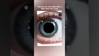 Dilating eyes  Watch the Related video [upl. by Anik122]