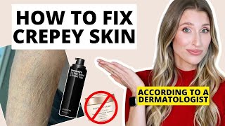 How to Fix Crepey Skin  Dermatologist Explains How to Firm Body Skin [upl. by Nyroc]