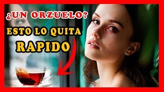 Como quitar un orzuelo del ojo rapido con remedios caseros naturalesRemedios para orzuelos [upl. by Laerdna235]