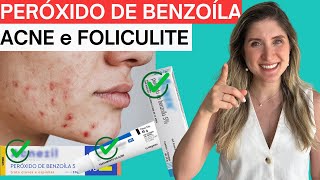 Peróxido de Benzoíla Acnezil Clindoxyl Acnen Dermotivin Benzac AcneFoliculite Pela Dermato [upl. by Euell]