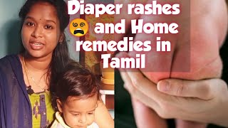 Diaper rashes and Home remedies in Tamil  Types of diaper rashes  How to prevent [upl. by Skutchan225]