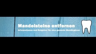 Mandelsteine entfernen  so einfach gehts [upl. by Suirred]