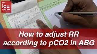 How to adjust Respiratory Rate RR according to pCO2 levels in ABG [upl. by Abekam550]