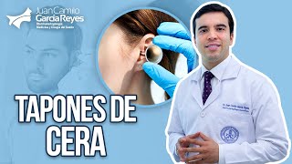 Oído tapado Tecnología para extraer tapones de cera  Dr Juan Camilo García Reyes [upl. by Bil417]