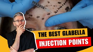 Injecting the glabella Injection Points amp Safety Advice [upl. by Clemens]