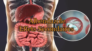 Effets secondaires Albendazole [upl. by Atronna]