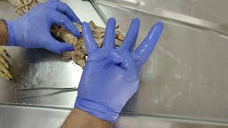 Dissection  Revision of Lumbricals of the hand [upl. by Anertak340]