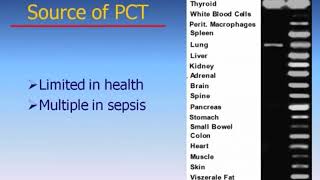 SEPSIS  Advances In The Early Detection and Management of Sepsis  US [upl. by Larue98]