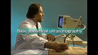 How to do abdominal ultrasound examination [upl. by Skippie]