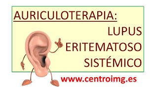 125 Auriculoterapia para el lupus eritematoso sistémico Centro IMG [upl. by Ahsenra788]