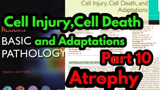 Atrophy Robbins Pathology Cellular adaptations Robbins pathologyGeneral pathology from Robbins [upl. by Derfliw]