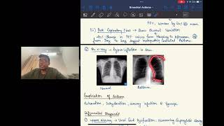 BRONCHIAL ASTHMA For University Studentsl Dr Sahil Bansal [upl. by Eitsym]