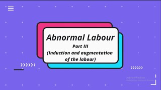 What is labor induction OBGYN answers 5 common questions about inducing labor  Stanford [upl. by Notrom]