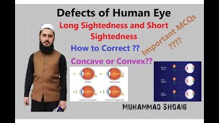 Short Sightedness and Long Sightedness Lec17 Class 10 Geometrical Optics EyeDefects [upl. by Angeli]