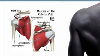 Shoulder Trauma Part 2 Tendons [upl. by Lorenza201]