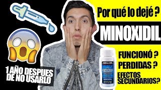 Por esto dejé el minoxidil 5 meses de tratamiento VICTOR CABALLERO [upl. by Kenny282]