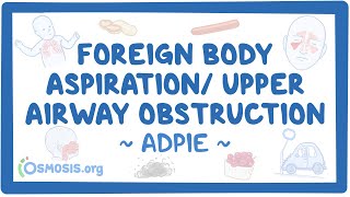 Foreign body aspiration  upper airway obstruction Nursing Process [upl. by Suivatnod331]