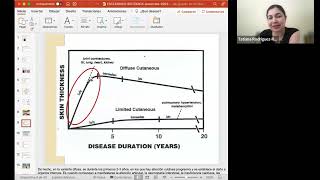 Recientes avances en el tratamiento de Esclerosis Sistémica Esclerodermia [upl. by Candi]