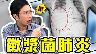 黴漿菌肺炎大爆發 感染症狀及藥物一次了解 [upl. by Schwing]