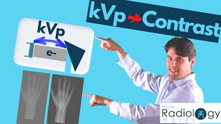 kVp and xray Contrast Guide for Radiologic Technologists [upl. by Annazus]