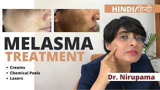 Melasma Treatment Melasma Treatment cream Melasma treatment laser Melasma treatment in Hindi [upl. by Tharp]