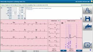 Welch Allyn® Diagnostic Cardiology Suite™ Physician Tools for Resting ECGs [upl. by Kciredec157]