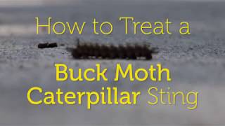 🐛 How to Treat a Buck Moth Caterpillar Sting [upl. by Adnoloy]