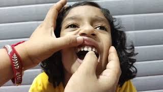 2023 Third Loose tooth 5 year old pulls out her own tooth Primary teethteeth [upl. by Akelahs217]