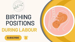 Birthing positions during labour [upl. by Prosperus129]