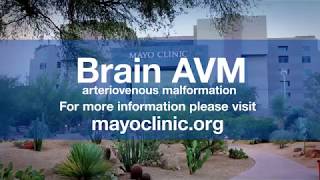 Dr Bernard Bendok Arteriovenous Malformation  Brain AVM [upl. by Otsedom]