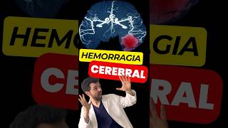 Dolor de Cabeza por Hemorragia Subaracnoidea 🤯🩸 [upl. by Aerdna]