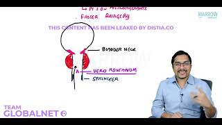 PROSTATE PART 2 By Dr Rohan khandelwal surgery by Marrow Video Lecture [upl. by Alohcin]