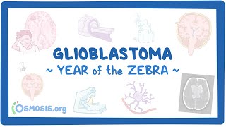 Glioblastoma Year of the Zebra [upl. by Eymaj11]