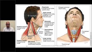 Neck lumps in general practice [upl. by Waylin]