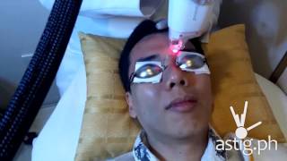 Luminisce Baby Skin Laser antiaging treatment [upl. by Kerwon]