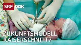 Kaiserschnitt  Die Geburt der Zukunft  Doku  SRF Dok [upl. by Aidnyl]